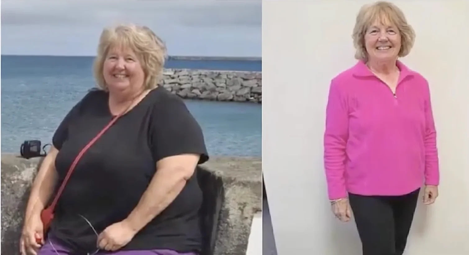 Miriam — before and after
