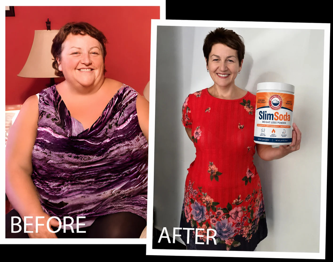 Vanessa — before and after